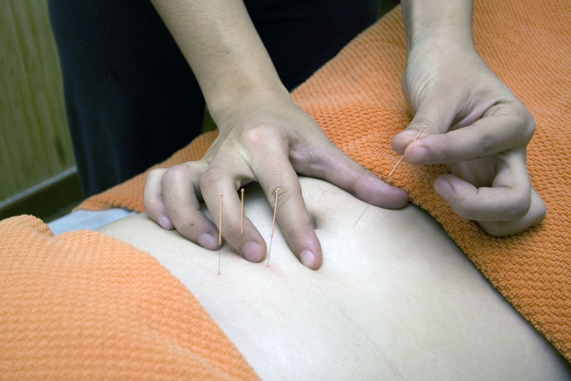 osteopathe-FONTAN-min_acupuncture-4175625